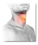 sore throat caused by acid reflux