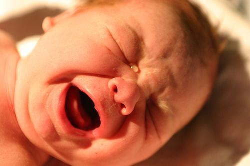 infant acid reflux symptoms